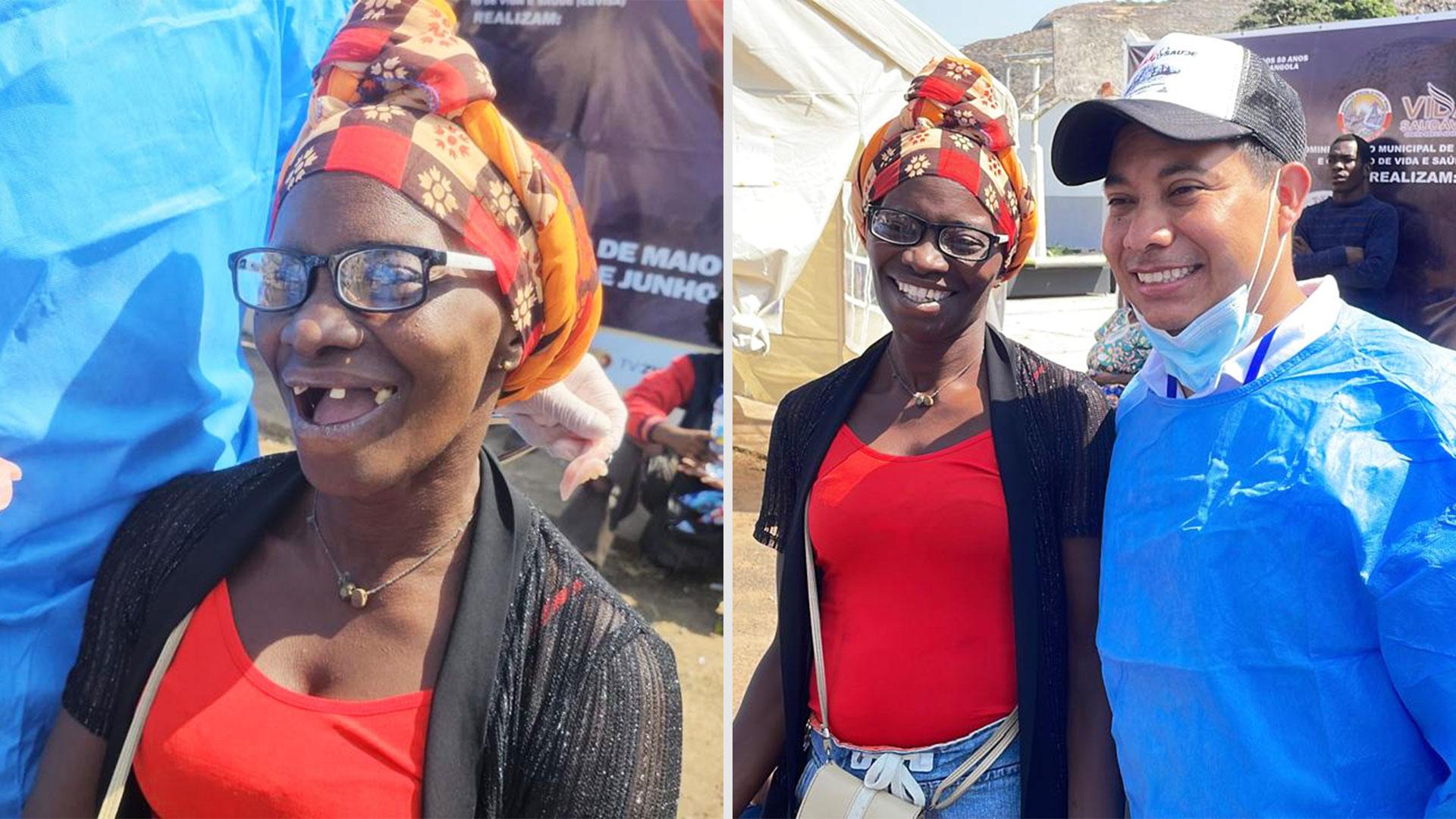 En la fotografía, el caso antes y después de una paciente que recibió una prótesis dental total durante una jornada de atención en Pungo Andongo, Angola, en 2024.&nbsp;Fotografía cortesía de Maydi Díaz.